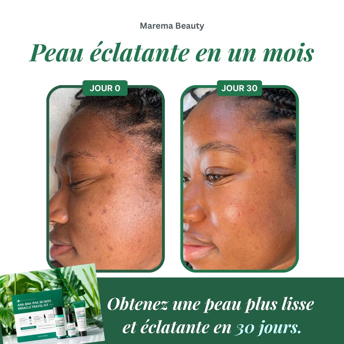 Transformez Votre Peau en 30 Jours avec